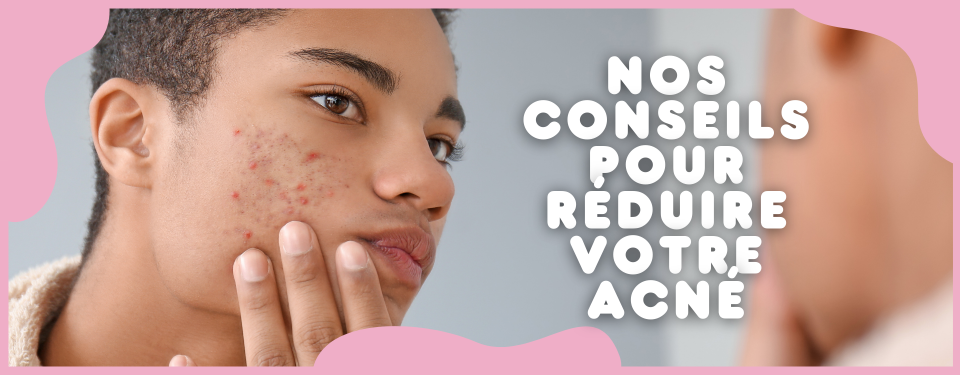 nos conseils contre l acne 1